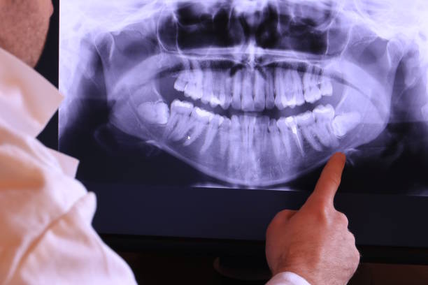 Best Emergency Dental Extractions in Brier, WA